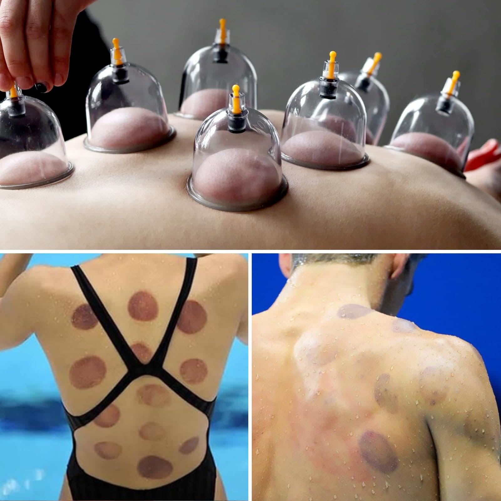 Cupluw Cupping Kit for Massage Therapy - 32 Cups Professional Chinese Cupping Set with Magnetics, Vacuum Cupping Therapy Set for Cellulite Reduction Muscle Pain Relief with Manual Pump Cupluw